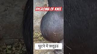 Hygroma of knee l Dr Umar Khan [upl. by Nalon]