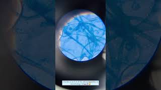 Rhizopus under microscope microbiology mbbsstudent [upl. by Suravart]