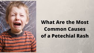 What Are the Most Common Causes of a Petechial Rash [upl. by Gally37]