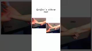 Golfers Elbow Test kattrucate medicalreels golfers elbow sign supination examiner shorts [upl. by Duquette917]