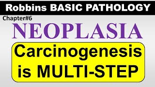 Chp6Part5 Robbins Basic Patho  CARCINOGENESIS A Multi step Process General Pathology Neoplasia [upl. by Ednarb]