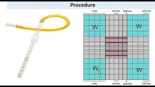 Total WBC counting by using hemocytometer  Neubaurs Chamber  urduhindi [upl. by Rausch]