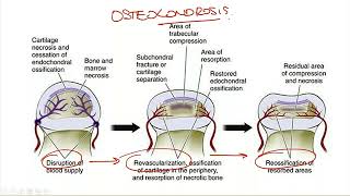 9 BANCO DE PREGUNTAS TRAUMATOLOGíA PARTE 9 NEOPLASIA Y ORTOPEDIA [upl. by Gautier]