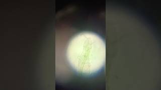 Rotifers undermicroscope bacteria labtech microbiology [upl. by Waylen]