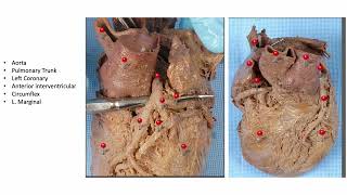 Thorax and Abdomen Rapid Review [upl. by Seuguh642]