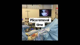 Anterior Knee Pain PLICA Surgery MoraMD theUFCfighterSurgeon [upl. by Lechner]