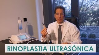 Rinoplastia Antes y después [upl. by Aramas433]