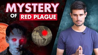 Mystery of Red Plague  Invention of World’s First Vaccine  Dhruv Rathee [upl. by Odlanra687]