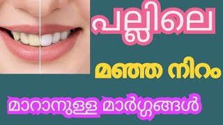 പല്ലിലെ കറയും മഞ്ഞ നിറവും കളയാനുള്ള മാർഗ്ഗങ്ങൾ libitha1019 informationvideos [upl. by Margaretta]