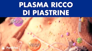 Plasma ricco di piastrine © [upl. by Gualtiero]