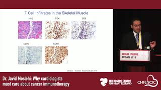 Dr Javid Moslehi Why cardiologists must care about cancer immunotherapy [upl. by Devon]