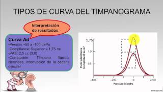 ¿Qué es una impedanciometría Examen de impedanciometría [upl. by Ennairda332]