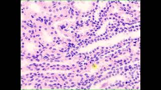 Simple cuboidal lining epithelium Kidney [upl. by Sima]