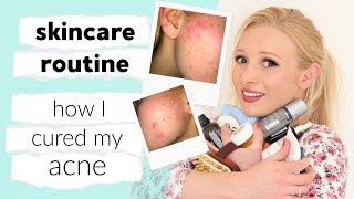 My full skin care routine amp how I CURED my acne [upl. by Nylrahs]