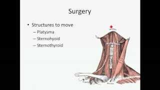 Thyroid Nodules  USMLE Step 2 Review [upl. by Arata]