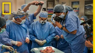 Youngest Face Transplant Recipient in US  National Geographic [upl. by Wilmott]