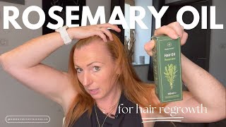 I Tried Using Rosemary Oil For 30 Days For Hair Regrowth — My Results [upl. by Naoh947]