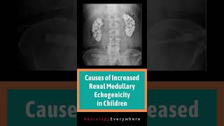 Renal Medullary Echogenicity  Medullary nephrocalcinosis  Radiology  causes  video 47  Shorts [upl. by Doane]