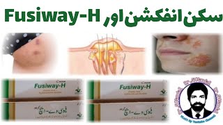 FusiwayH Cream  FusiwayH Best in Skin Infection  DrAHMandal Urdu  Hindi [upl. by Ivy]