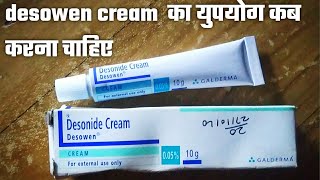 Desowen cream uses in hindi Desonide cream 005 ww  Desonide cream  Desowen cream price [upl. by Akeimat]