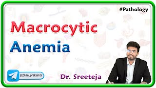 4 Macrocytic Anemia  USMLE Step 1 Pathology [upl. by Marigolda]