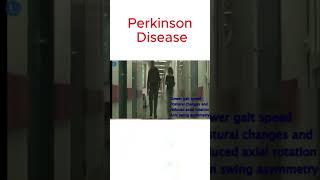 Gait impairment in Parkinson [upl. by Welles]