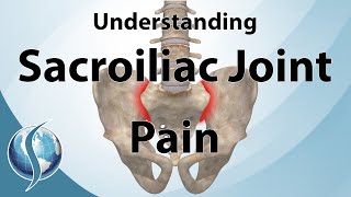 Understanding Sacroiliac Joint Pain [upl. by Oconnor]