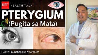 Pterygium Pugita sa Mata Causes Symptoms Complications Treatment amp Prevention [upl. by Imak]