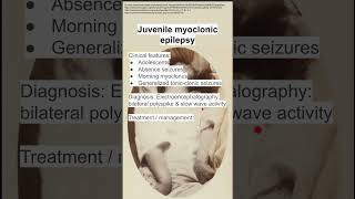 Juvenile myoclonic epilepsy [upl. by Karlise]