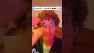 sulfuric acid skin test 🤗🧪 shorts memes funny [upl. by Ennaesor]