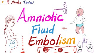 Amniotic Fluid Embolism  ObGyn Pathology Lectures  5MinuteReview Series [upl. by Lyssa]