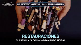 Restauraciones Clase III y IV con Alargamiento Incisal  Parte 1 [upl. by Nyad622]