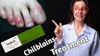 what is Chilblains chilblains treatment Doctor farzana [upl. by Oloapnaig163]