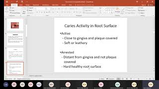 Lecture  9 Root caries [upl. by Madlin]