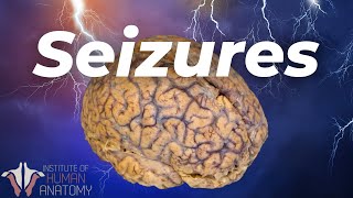 Whats Actually Happening During a Seizure [upl. by Narba]