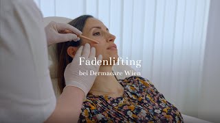 Fadenlifting bei Dermacare Wien [upl. by Ermey]