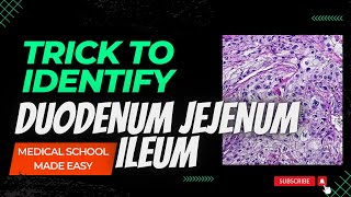 Simple TRICK To Identify Histology Of Duodenum Jejunum Ileum [upl. by Cherie]