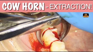 COWHORN TOOTH EXTRACTION  4K Resolution [upl. by Trabue]