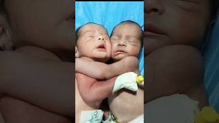 twins brothers shorts twins viral vedio brothers nicu [upl. by Repooc]