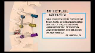 NAUTILUS Pedicle Screw System [upl. by Affer]