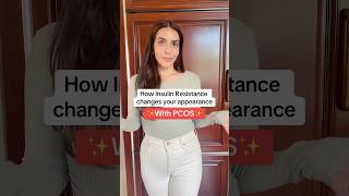 How Insulin Resistance changes your appearance with pcos [upl. by Octavie]