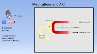 Acute Kidney Injury Part 13  Definitions and Etiologies [upl. by Pauline423]