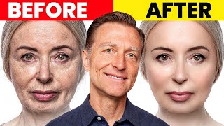 The Ultimate Face Transformation–Dr Bergs Best Remedy for Dry Skin and Wrinkles [upl. by Yrred]