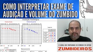 Como Interpretar Exame de Audição e Volume de Zumbido [upl. by Rednirah222]