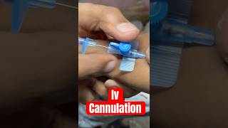 Iv cannulation cannula ivtherapy mbbs aiims SMpharmacy subscribe medicalequipment [upl. by Hanford]