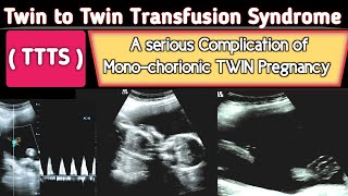 TTTS  Twin to Twin Transfusion Syndrome Ultrasound  A Serious COMPLICATION [upl. by Cyrille]