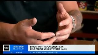 Cant stop biting your nails Habit replacement therapy might help [upl. by Hillell]