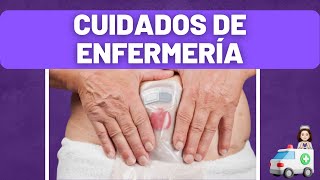 OSTOMÍA Cuidados de enfermería en el PRE Y POSTOPERATORIO 👩‍⚕️ [upl. by Adrianna]