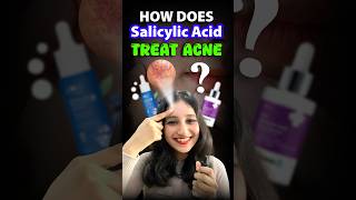 How does Salicylic acid treat acne acne salicylicacid serum csirnet neet biology sciencefact [upl. by Mintz]