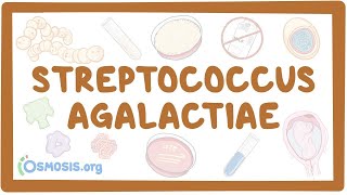 Streptococcus agalactiae group B strep  an Osmosis Preview [upl. by Ahsienahs]